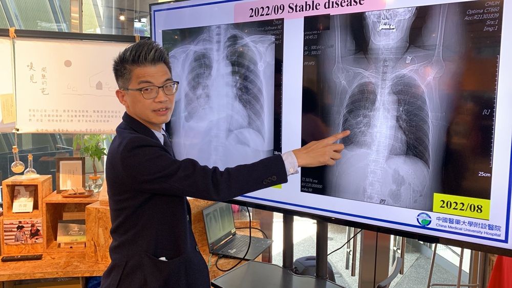 經過第三線標靶藥物治療兩個月,林女士右肺的肺積水消失,右側原本霧濛濛一片化為清明,身體狀況大為改善。曾雪蒨攝