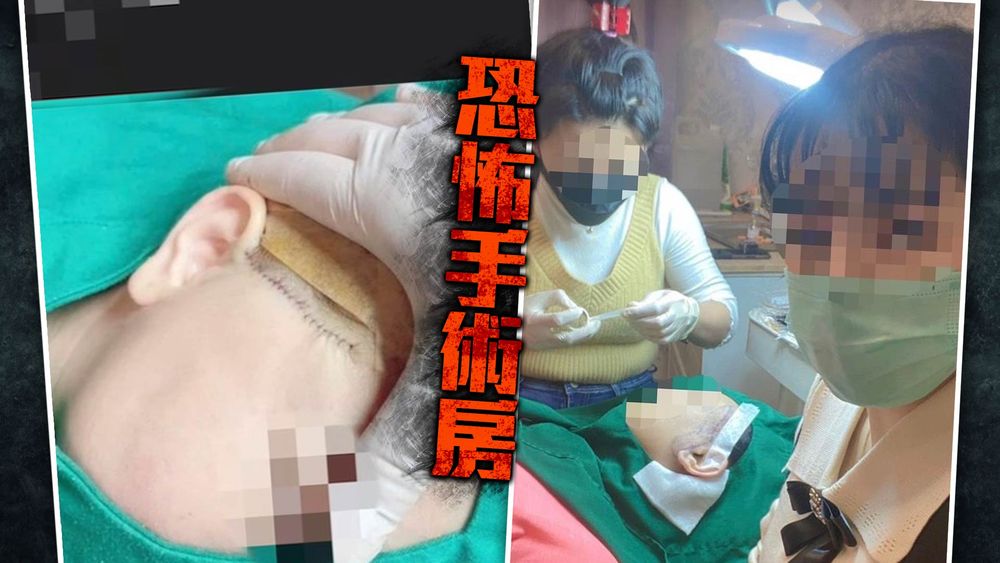 隆鼻 豐唇樣樣來恐怖 高雄雙姝學一天就持刀幫整形