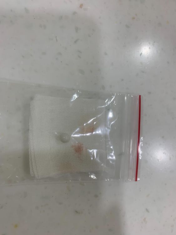 白狗的飼主帶牠到動物醫院就醫，從傷口取出一顆BB彈。翻攝自爆料公社