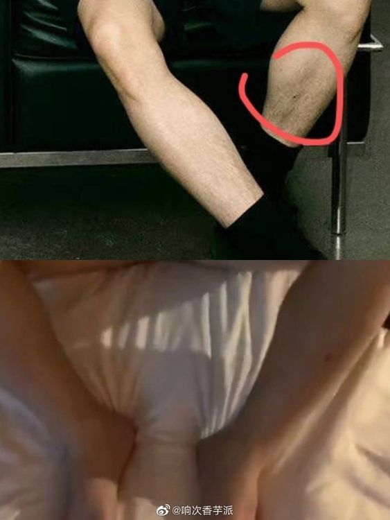 性愛片男主角和李易峰腿上都有一顆痣。翻攝微博