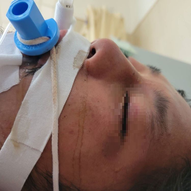 林男因顱內嚴重出血，宣告不治。讀者提供