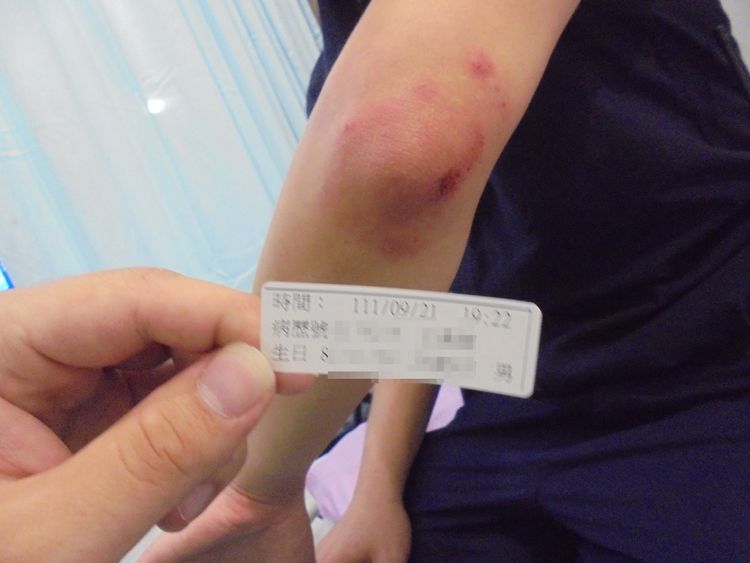 方姓女警手腕撕裂傷。中壢警分局提供