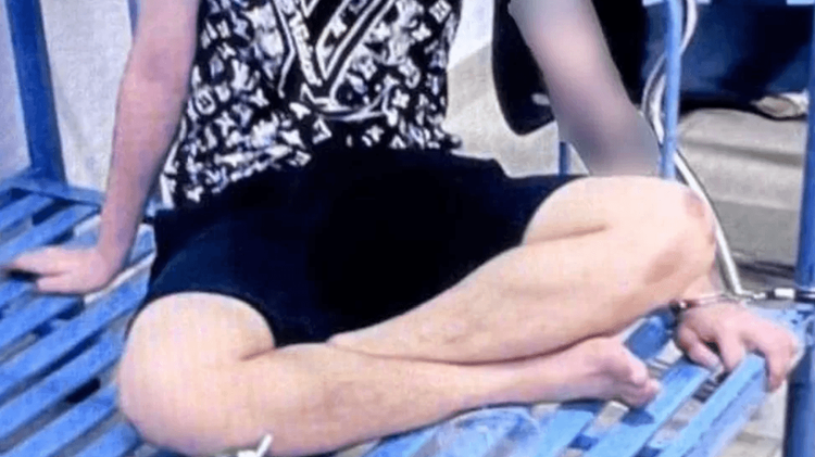 越南青年被銬在鐵床上，膝蓋是被電擊造成的疤痕。翻攝BBC網頁