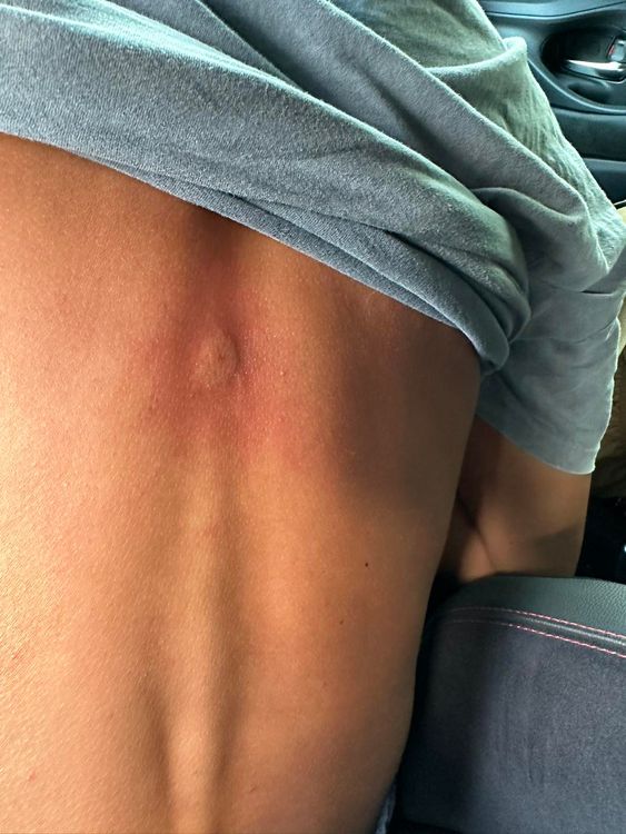 偷親他的是一隻虎頭蜂。引自吳慷仁臉書