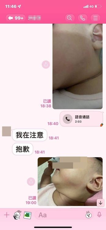 女嬰嬤向托育的洪姓保母質問女嬰臉傷。家屬提供