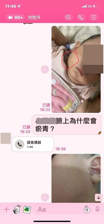 女嬰家屬跟保母質疑為何女嬰有淤青。家屬提供
