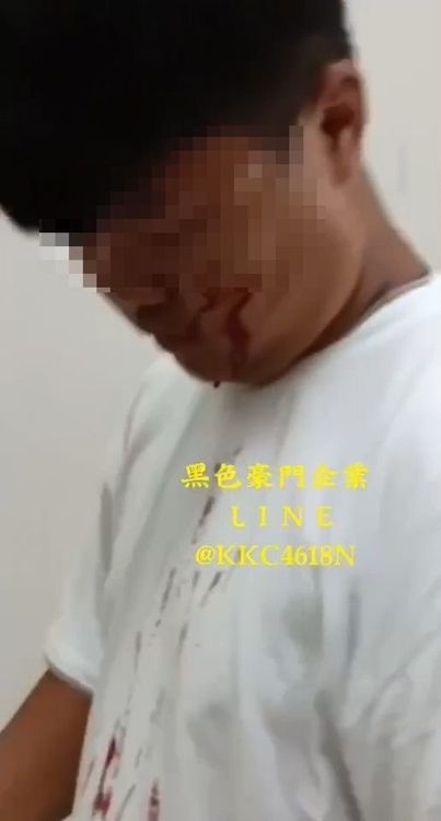 一名男同學被美工刀劃傷，在教室內掛彩。翻攝黑色豪門企業LINE