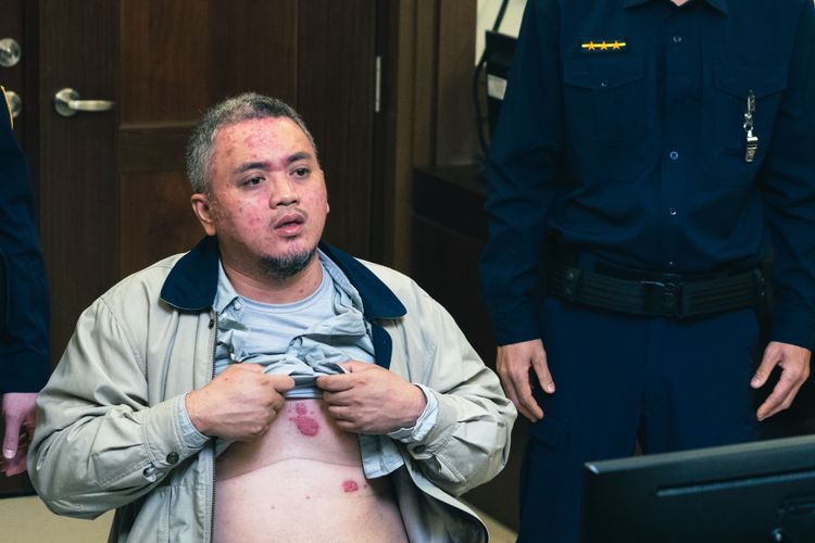 王鏡冠全身過敏發紅。三禾行銷提供