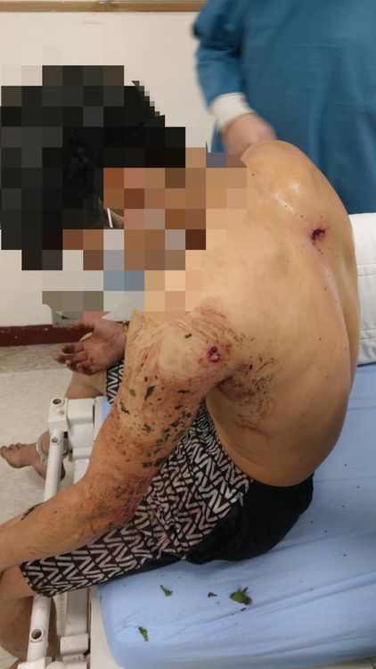 范男經過１天逃逸仍被逮捕，左肩也遭到子彈擊中。民眾提供