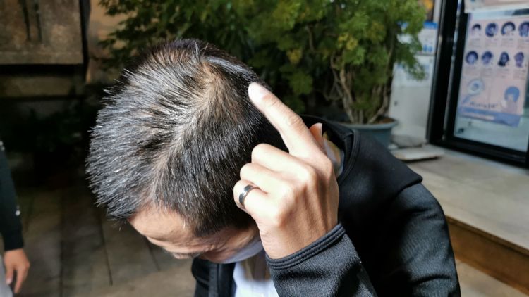 翁聖潍表示頭部遭到毆傷。陸運鋒攝