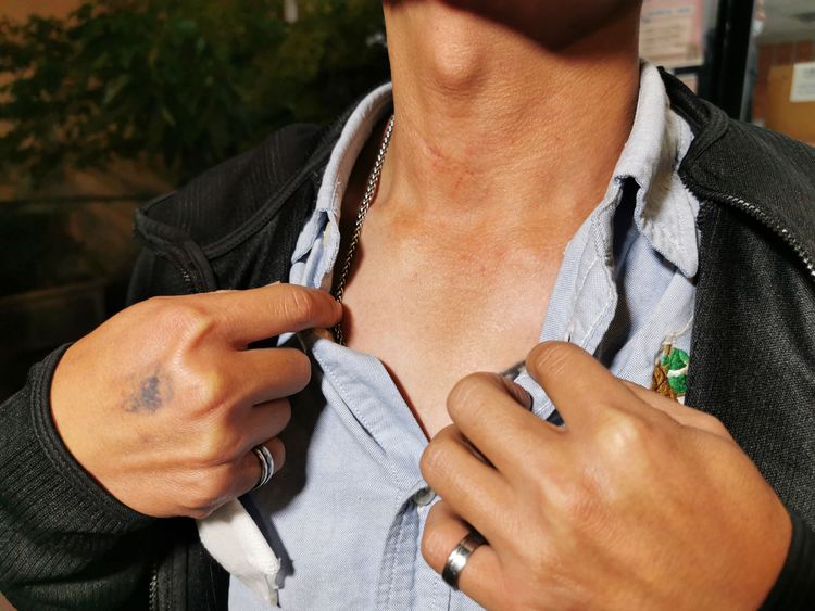 翁聖潍胸口也受傷。陸運鋒攝