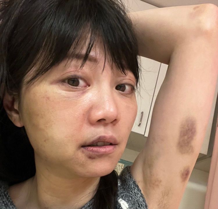 高嘉瑜被林秉樞爆打。高嘉瑜辦公室提供