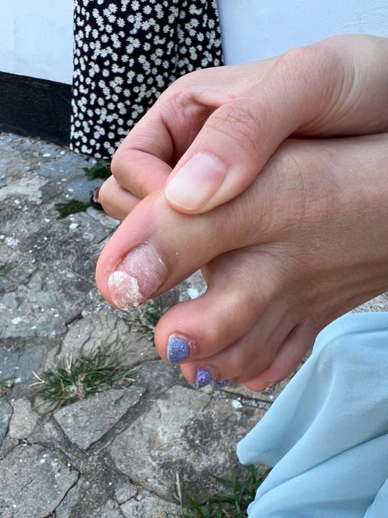 康茵茵不小心受傷。維恩原創Rocky提供