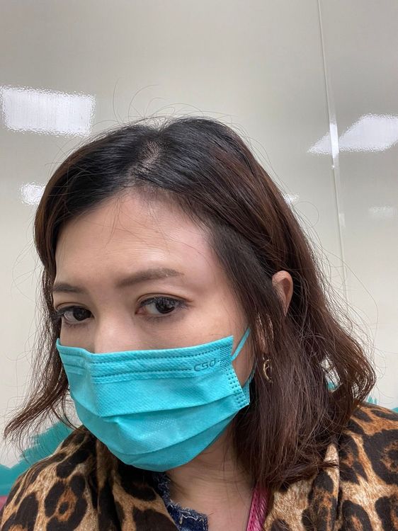 廖家儀當時車禍額頭都腫了。民視提供