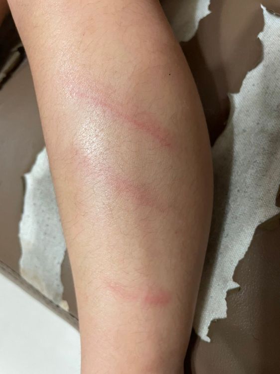 還有一幼童到校上課回家時腿上多了疑似鞭打的傷痕。市議員林祈烽提供