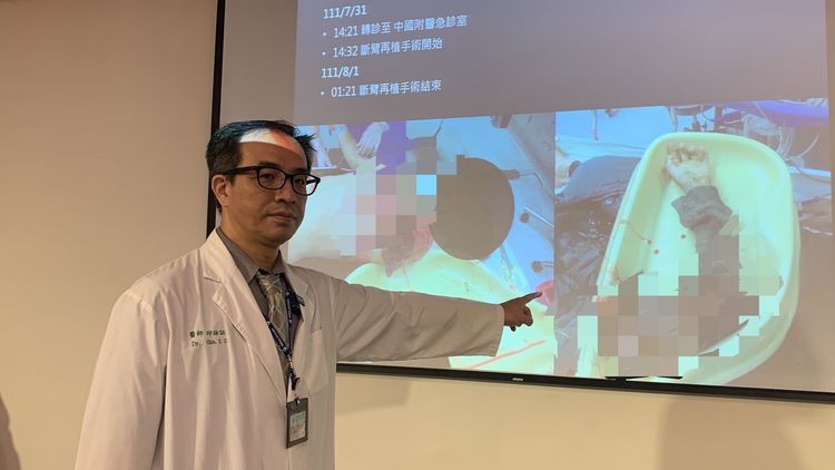 邱詠証醫師說明患者肩膀以下手臂完全撕裂斷裂，是他行醫以來碰過最嚴重的斷臂個案。曾雪蒨攝