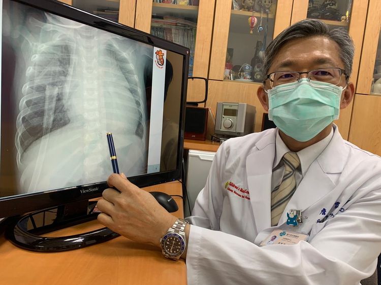 台中榮總兒童心臟科主任詹聖霖說明男嬰染疫後併發猛爆性心肌炎，心臟衰竭命在旦夕。曾雪蒨攝