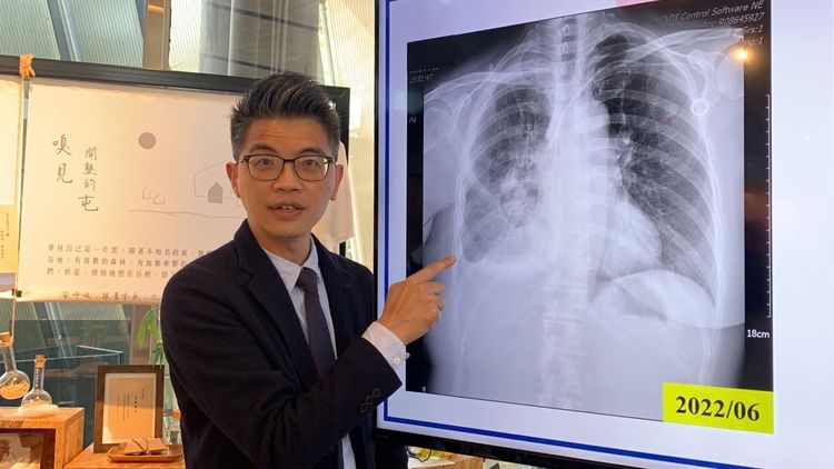 劉良智主任以影像說明林女士乳癌轉移到右肺，導致嚴重肺積水，病況相當嚴重。曾雪蒨攝