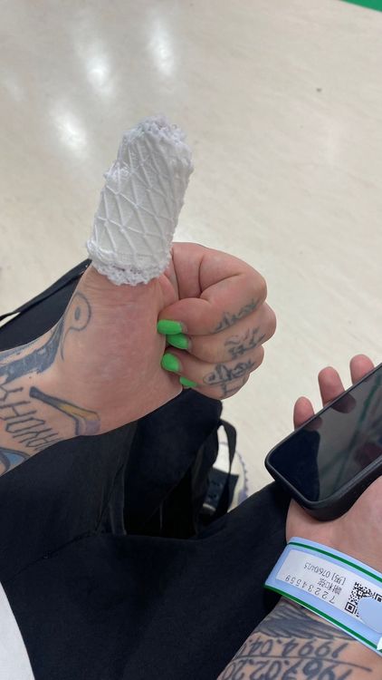 謝和弦母指被老鼠咬傷。陳緗妮提供