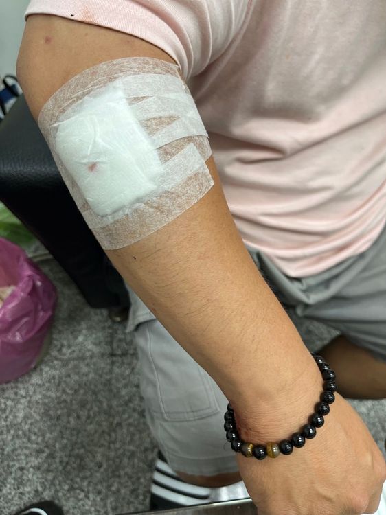 鄭男右手臂遭鋼珠擦傷。三重警分局提供