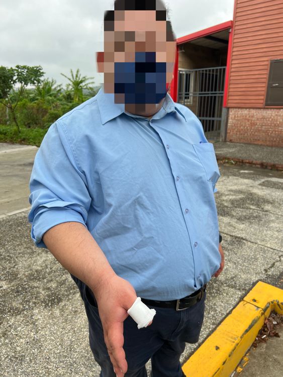 董男右手大拇指遭割傷。淡水警分局提供