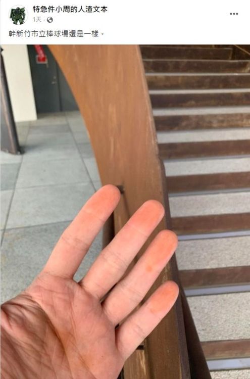 網紅人渣文本周偉航在臉書貼出照片，只見他摸過樓梯扶手的雙手出現橘紅色鏽蝕粉末。翻攝自特急件小周的人渣文本粉絲頁