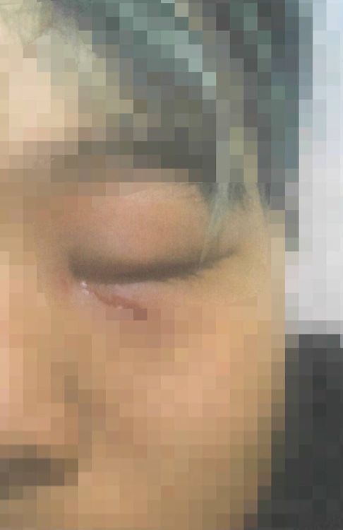 被毆打成傷的台灣「豬仔」。警方提供