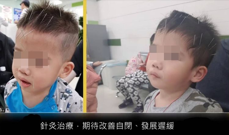 小捷歷經艱辛的復健治療，希望能夠改善自閉症病情。家屬提供