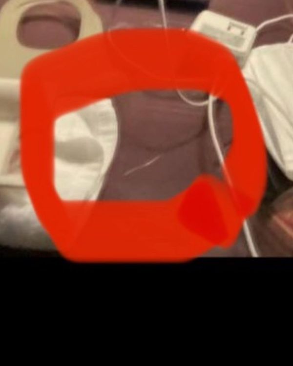 東谷義和說紅圈處是古柯鹼。翻攝東谷義和IG