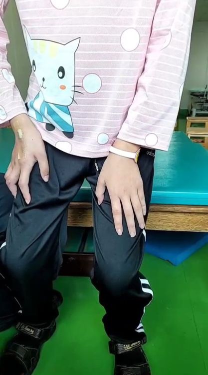 陳女已可做出稍微蹲下的動作。讀者提供