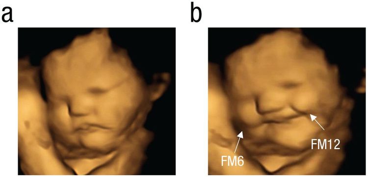 b組寶寶笑了，因為他媽吃的是胡蘿蔔口味的膠囊。翻攝《Sage Journals》