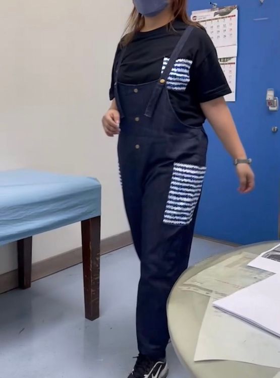 女大生在接受微創人工髖關節置換手術後，兩隻腳一樣長，不須拐杖也行走自如。大里仁愛醫院提供