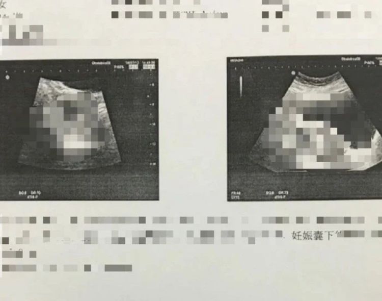 女友告訴他懷孕的消息，但卻不願接受驗DNA。翻攝Dcard