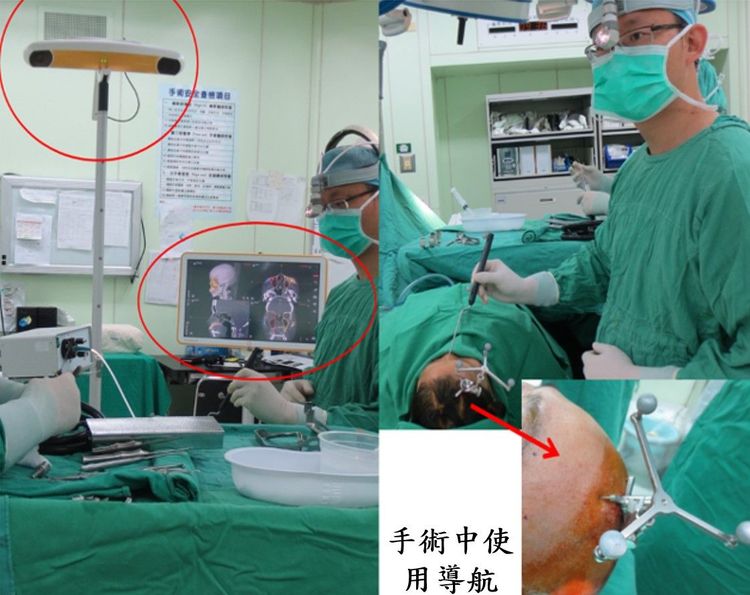 手術中使用導航輔助。大里仁愛醫院提供