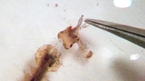 看似無用孑孓擁驚人技能 能把頭射出去吃年幼同類