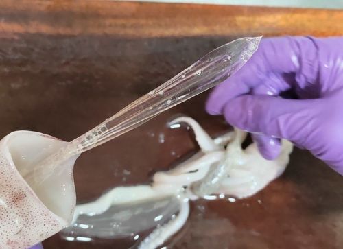 南投男「奢侈吃海鮮」 這骨頭差點要他命