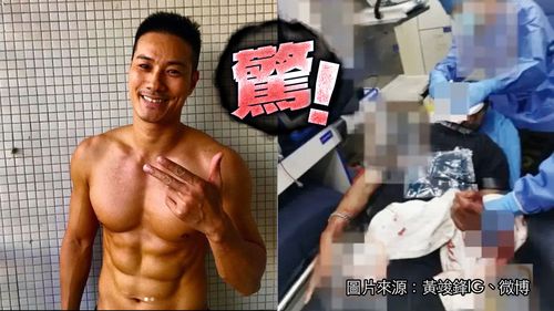 「翻版古天樂」餐廳遭歹徒狂砍3刀 親眼看到臉皮掉下來