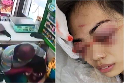 曾活生生咬死狗還砍人!惡男又挖眼超商女店員 二審判決出爐