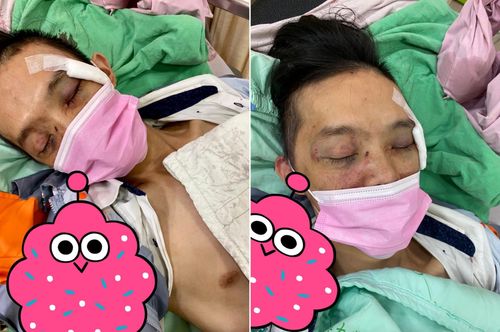 台中莽男不滿被勸戴口罩　打斷店員10根肋骨！一審判決出爐