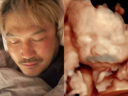 KID曬兒子超音波照　父子睡臉神同步！網笑翻「小余天」