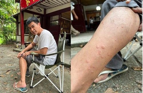 潘逸安台南拍戲露天大號遭小黑蚊攻擊　烈日光腳踩柏油路根本燙肉