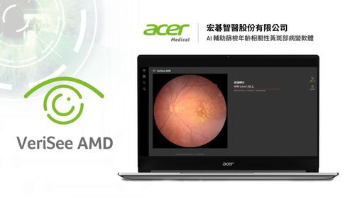 宏碁智醫第7張醫材證入手!AI篩檢軟體獲食藥署眼科醫材許可證