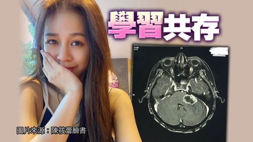 甜美女星腦瘤復發!治療1年掉髮常摔倒 悲吐心聲:我一點都不樂觀