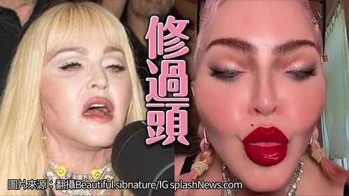 瑪丹娜P圖+整形驚變膠女 超級豐唇嚇死粉絲