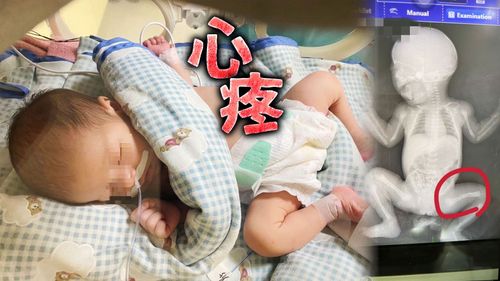 一張骨折照惹哭爸媽!台中新生女嬰住院疑受虐 家屬開吉了