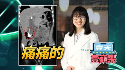 6歲童腹痛竟是膽結石開刀切除　醫師：有3成找不出病因