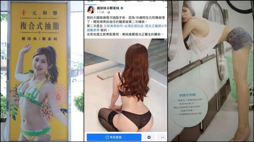 被雞排妹指「抽脂做壞了」 醫美診所告誹謗不成!另求償300萬