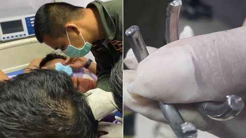 鐵環套鳥4年拼「小雞變大鵰」　他增大失敗險自廢命根